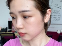 -美莱医疗美容医院