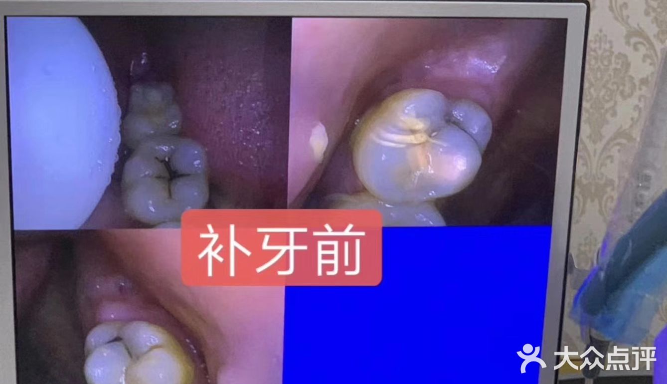 儿童牙科知识必知