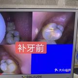 儿童牙科知识必知