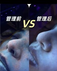点击看大图 -SKIN79皮肤管理中心