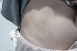 -雲艺刺青·洗纹身