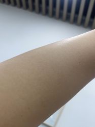 体验后-素美医疗美容·西南眼鼻整形·修复基地
