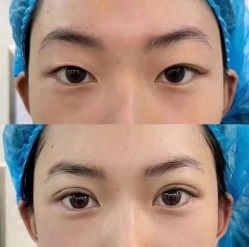 -郡艺医疗美容·微整·眼鼻吸脂
