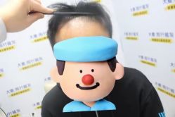 -大麦微针植发丨全国连锁