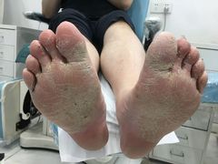 -世龙世家灰指甲·甲沟炎·跖疣护理·修脚(东江湾路店)