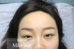 -MISS STAR·半永久纹眉·发际线·美瞳线