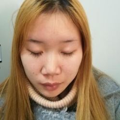 点击看大图 -成都西区医院整形美容