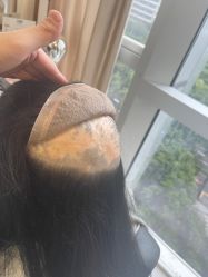 -发饰美男士增发补发假发定制店