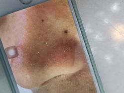 -痘敏医生专业祛痘·肌肤修复连锁