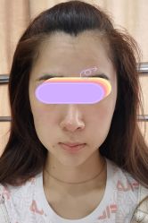 点击看大图 -广州美莱医疗美容医院