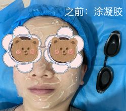 体验前-西安壹加壹医疗美容医院