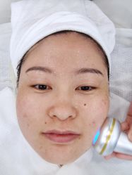 -悟空祛痘·诺奖技术专业店