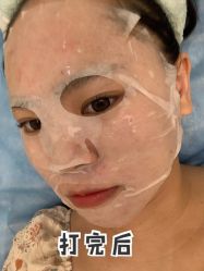 体验前-南宁华美医疗美容医院