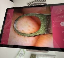 -凡碧诗毛孔清洁收细