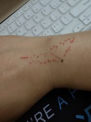 -天道专业洗纹身