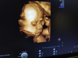 -杭州贝瑞斯美华妇儿医院·早孕·产检·儿科