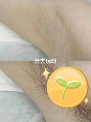 体验前-清颜堂丨分子祛痘·功效美肤