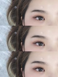 -U-Nail