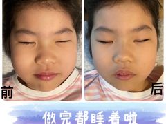 -修申骨雕小颜脊柱骨盆管理产后修复