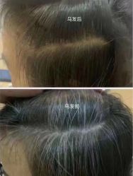 -希梵尔头皮抗衰·科技养发
