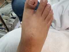 -世龙世家灰指甲鸡眼脚气甲沟炎跖疣护理(通州店)