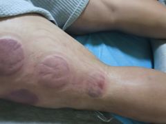 -张钰强中医正骨推拿连锁(唐家人才公寓店)