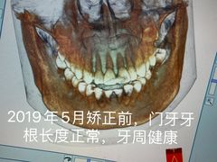 -团圆口腔·种植中心(锦江院区)