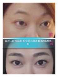 iphone_upload_pic-百秀名媛纹绣美学护肤中心