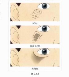 -倩极·精研痘敏肌管理