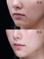 -深圳艺星医疗美容医院
