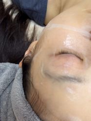 -长沙雅美医疗美容医院