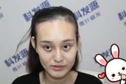 点击看大图 -大麦微针植发丨全国连锁