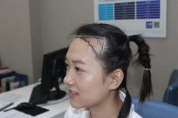 点击看大图 -大麦微针植发丨全国连锁