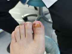 -世龙世家甲沟炎·灰指甲·嵌甲矫正·修脚(武侯区双楠店)