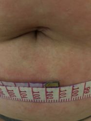 -肥三针腧穴瘦身馆