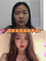 -成都西区医院整形美容