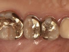 -精德口腔·种植修复·儿牙中心(财富中心店)