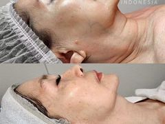 -证大大拇指广场(芳甸路店)