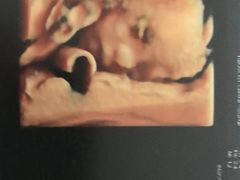 -天津市第一中心医院(复康路院区)