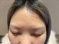 -长沙雅美医疗美容医院
