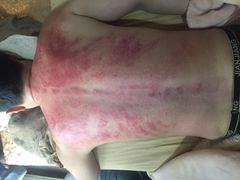 -御瀚文堂艾灸馆