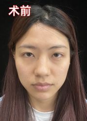 -素美医疗美容·西南眼鼻整形·修复基地