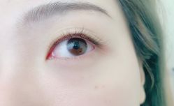 -宥莉·ULLY 痘敏肌•科技皮肤管理中心