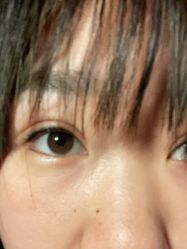 -北京叶子整形美容医院