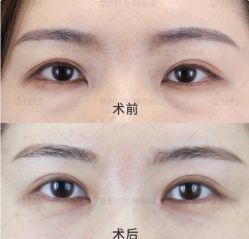 -丰联丽格医疗美容·联合丽格眼整形中心