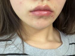 -青岛诺德医学美容医院