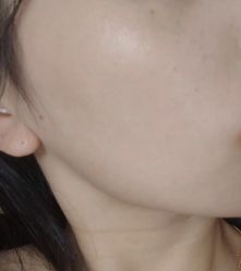 -美瑞莎创美医疗美容