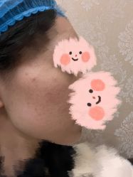 体验前-南京医科大学友谊整形外科医院