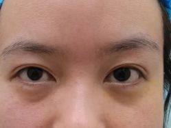 体验前-禾丽康美医疗美容医院