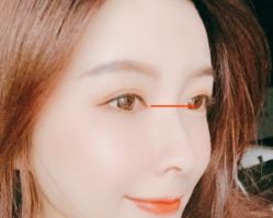 点击看大图 -SKINIST丽铂医疗美容